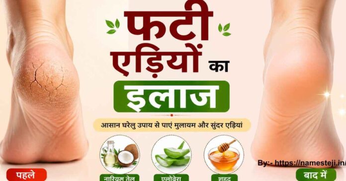 फटी एड़ियों के लिए घरेलू उपचार और पैरों की देखभाल करते हुए महिला।