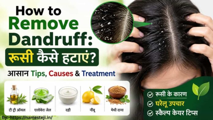 How to Remove Dandruff – रूसी हटाने के प्राकृतिक तरीके और स्कैल्प केयर टिप्स